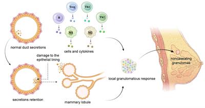 Immune pathogenesis of idiopathic granulomatous mastitis: from etiology toward therapeutic approaches